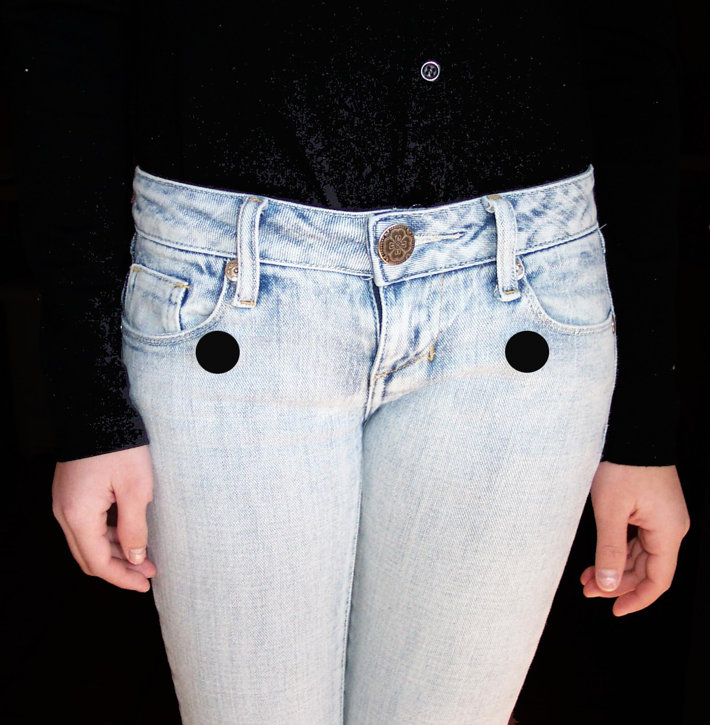 Hip Swelling